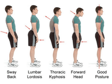 Load image into Gallery viewer, Body Fit Adjustable Posture Corrector
